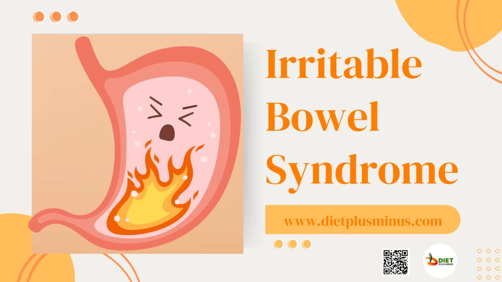 Irritable Bowel Syndrome