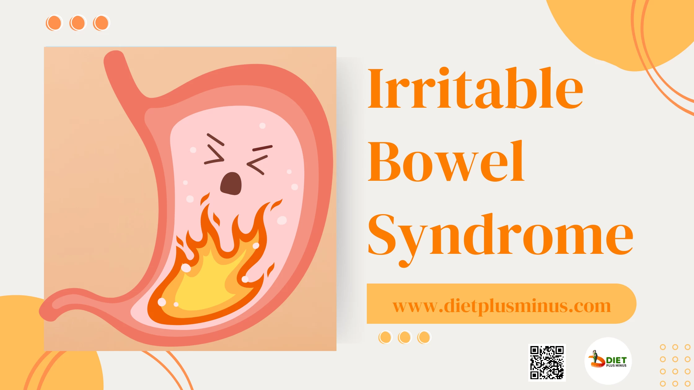 Irritable bowel syndrome