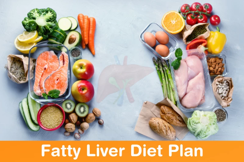 Fatty Liver Diet Plans
