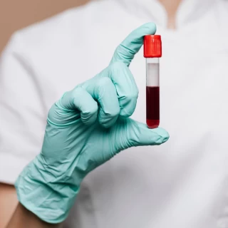 _Intermittent Fasting and Blood Tests How Fasting Affects Blood Test Results.2