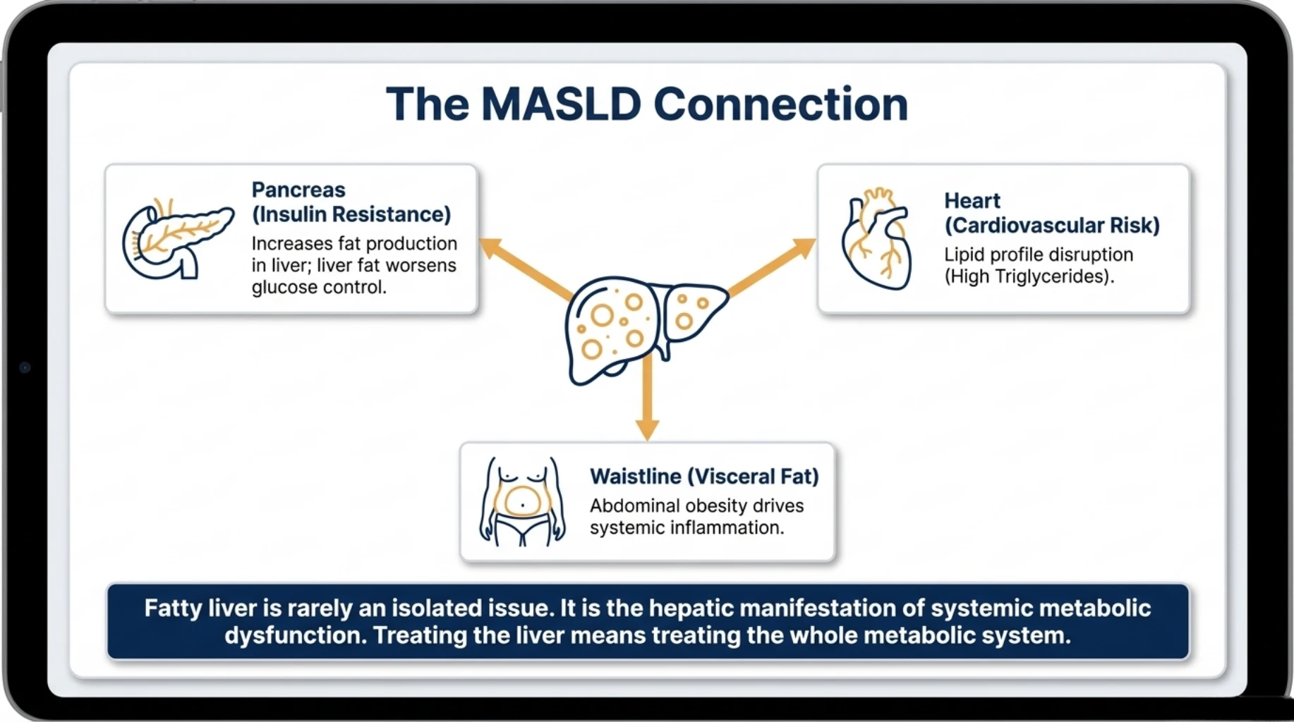 Diagram illustrating the connection between MASLD, insulin resistance, cardiovascular disease, abdominal obesity, and systemic metabolic dysfunction.