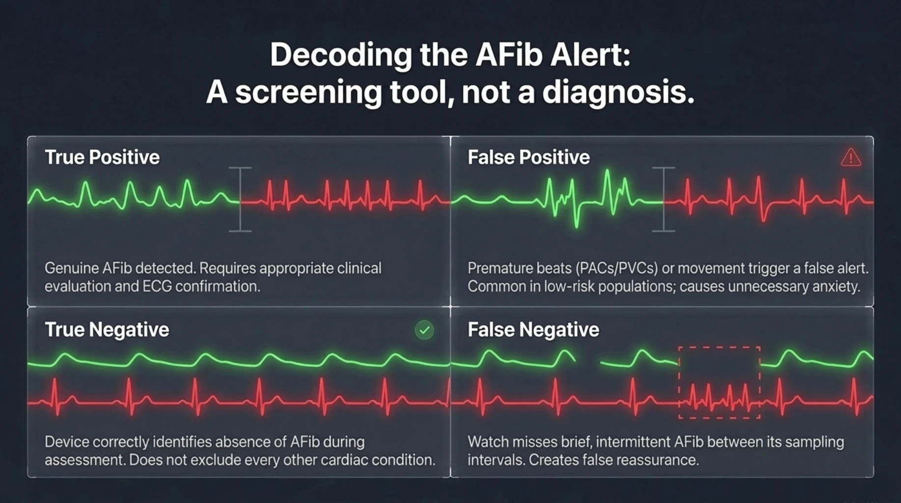 Smartwatch atrial fibrillation screening showing true-positive, false-positive, true-negative and false-negative results and why AFib alerts require clinical ECG confirmation