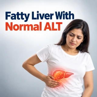 fatty liver with normal ALT