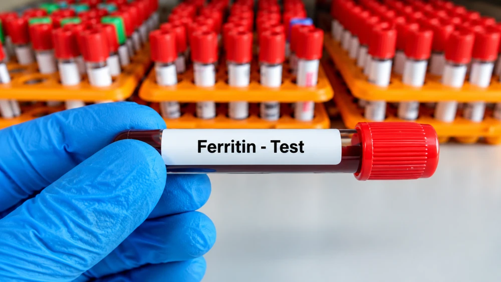 High Ferritin and Fatty Liver