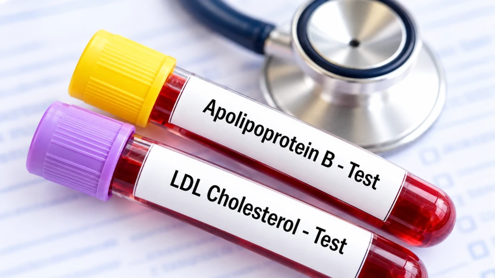 ApoB vs LDL Cholesterol