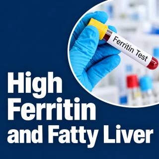 High Ferritin and Fatty Liver