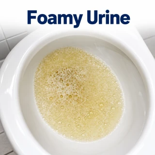 Foamy Urine