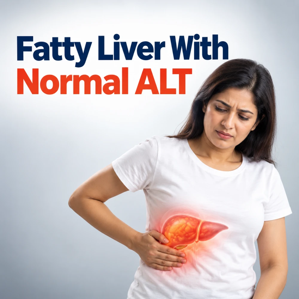 fatty liver with normal ALT