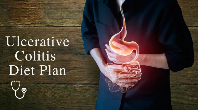Ulcerative Colitis Diet Plan